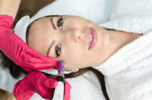 why microneedling was one of the most popular treatments of 2019 6087fe815ae52