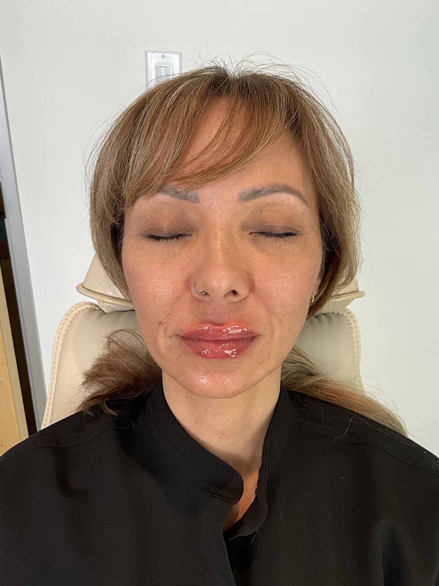 After Image: Fillers - front